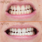 Lab Life Teeth Whitening Trio - Lab Life Beauty Eclipse Whitening System, Whitening Serum and Enamel Serum