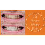 Lab Life Teeth Whitening Trio - Lab Life Beauty Eclipse Whitening System, Whitening Serum and Enamel Serum