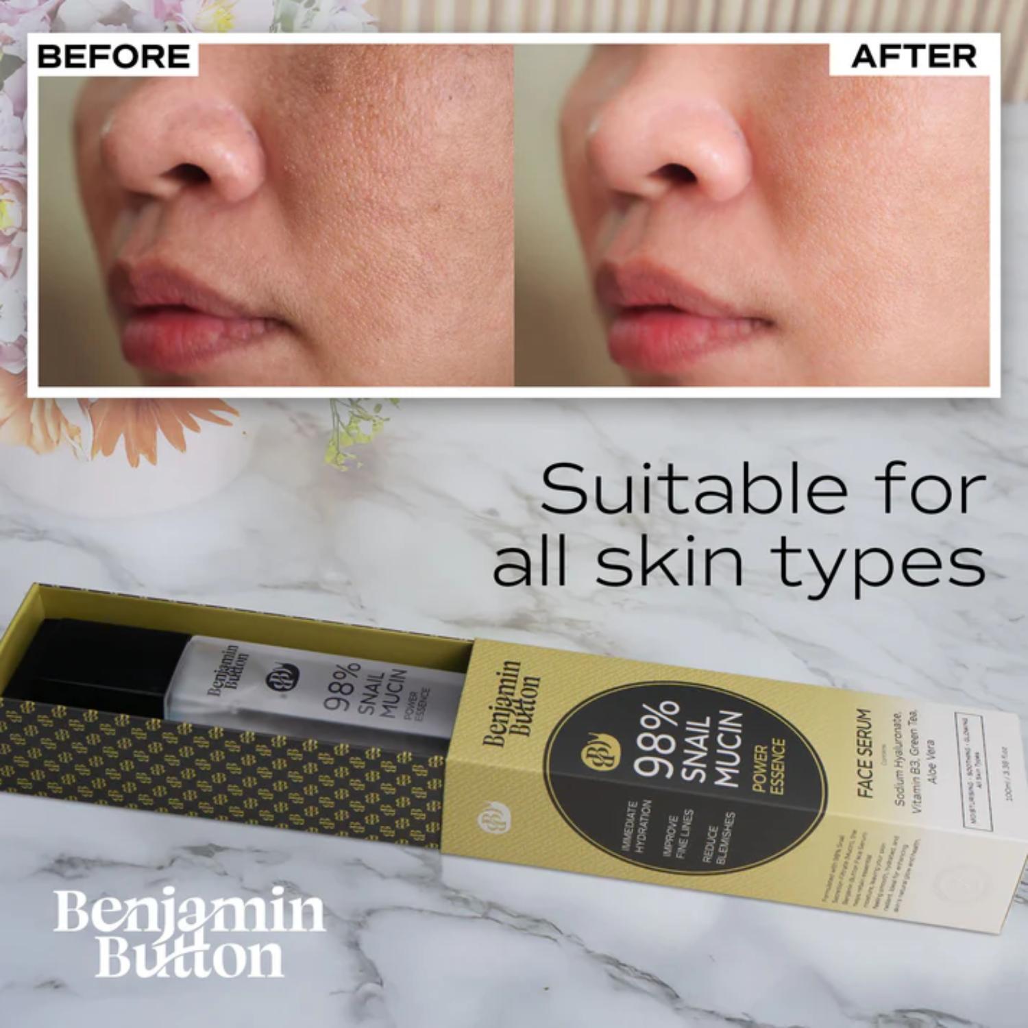 Set of Two Benjamin Button Snail Serum with 98% Snail Mucin - 100ml_440001118_4