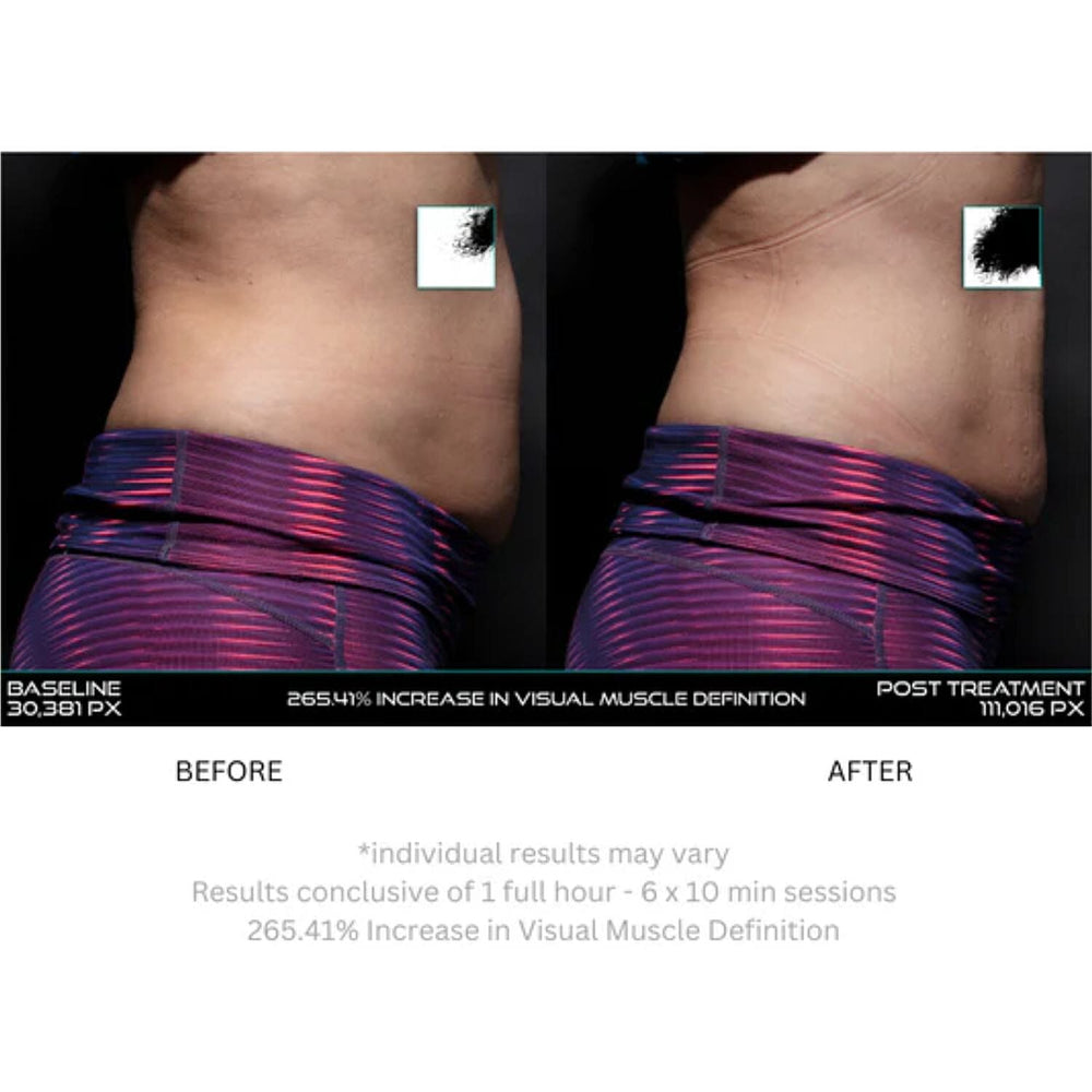 Lunamour Nufit Pro LED - Far Infra-Red EMS Slimming Belt (Exclusive Lifetime Warranty)