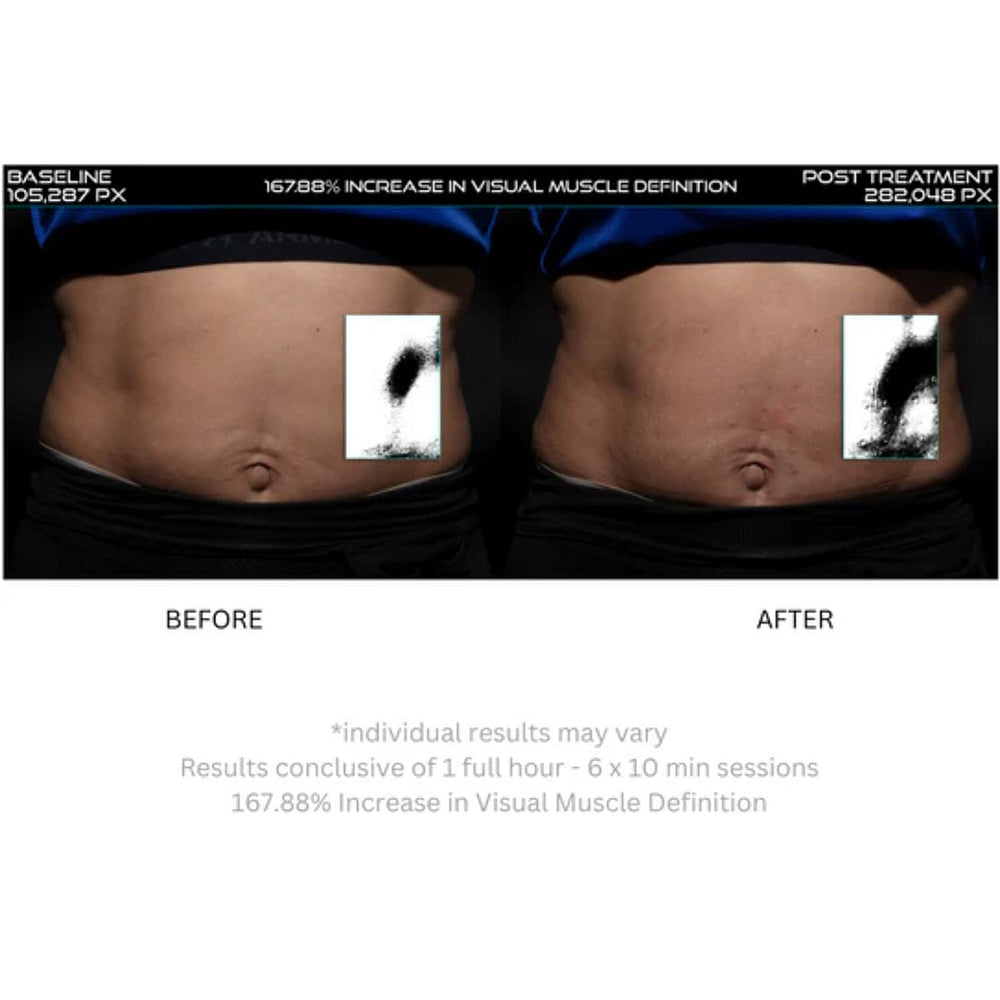Lunamour Nufit Pro LED - Far Infra-Red EMS Slimming Belt (Exclusive Lifetime Warranty)