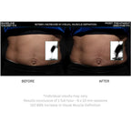 Lunamour Nufit Pro LED - Far Infra-Red EMS Slimming Belt (Exclusive Lifetime Warranty)