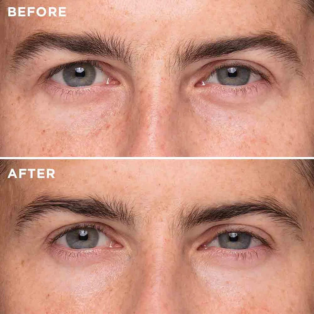 Instant Effects Eye Lift 8ml