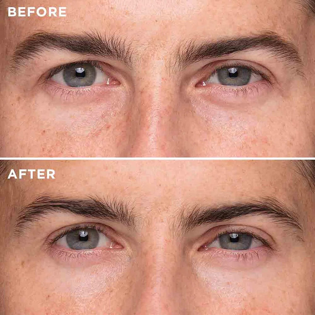 Instant Effects Eye Lift 8ml