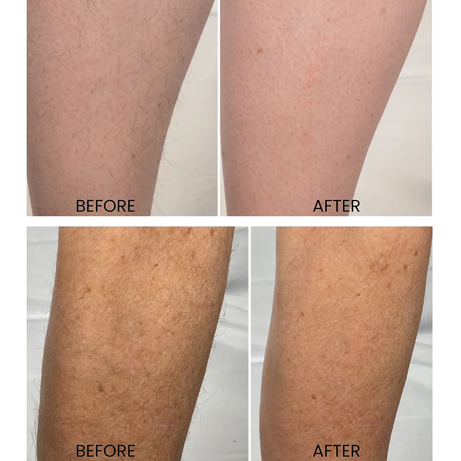 Lab Life Beauty Waxing, Bleaches and Depilatories - 1 pc