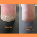 Lab Life Beauty Waxing, Bleaches and Depilatories - 1 pc