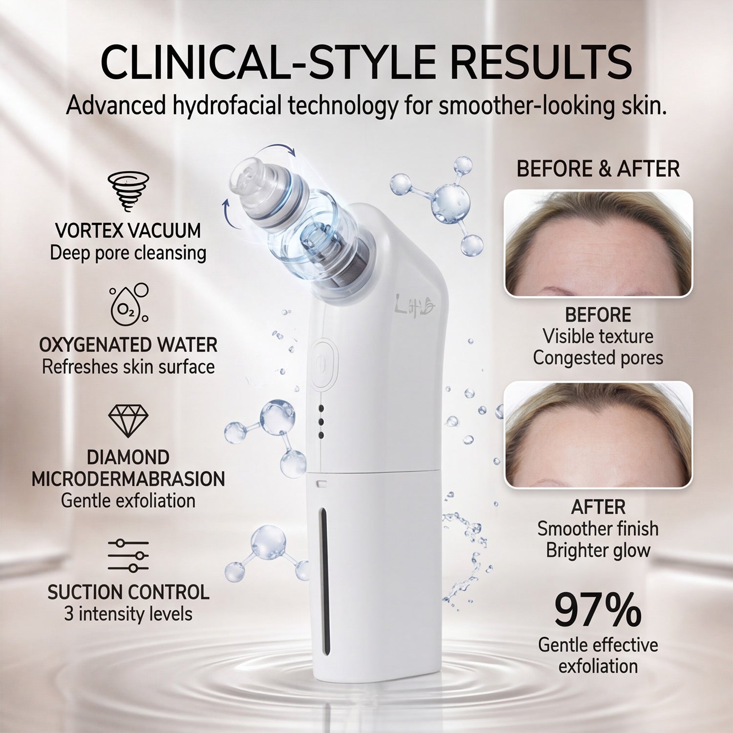 Lab Life Beauty Hydroderm Pro Facial Device - Lifetime Warranty