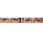 Lab Life Elysium Viscero-Dermal LED Powerful Face Device (660 LED Lights) - Exclusive Lifetime Warranty