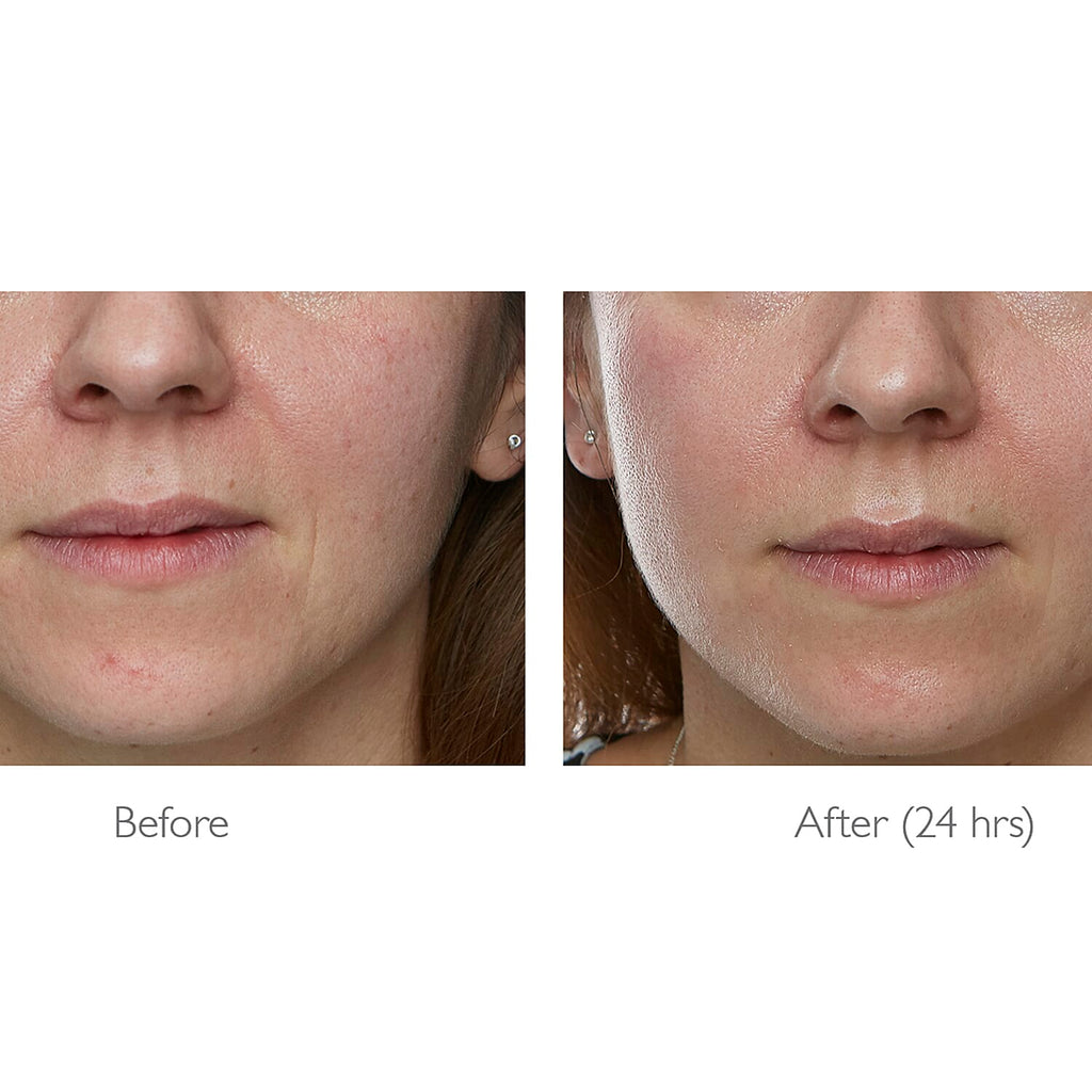 Lab Life Elysium Viscero-Dermal LED Powerful Face Device (660 LED Lights) - Exclusive Lifetime Warranty
