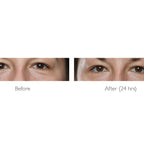 Lab Life Elysium Viscero-Dermal LED Powerful Face Device (660 LED Lights) - Exclusive Lifetime Warranty