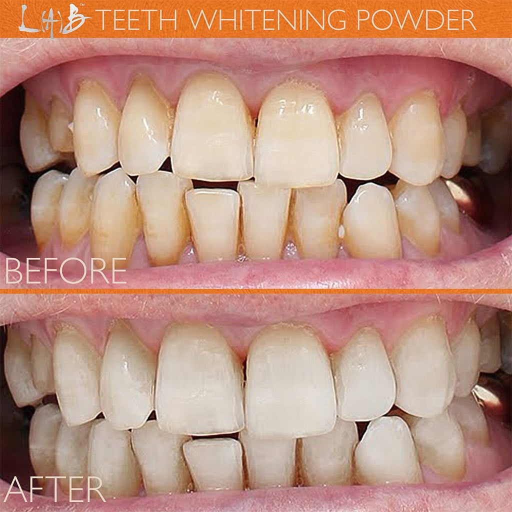 Lab Life Whitening Powder