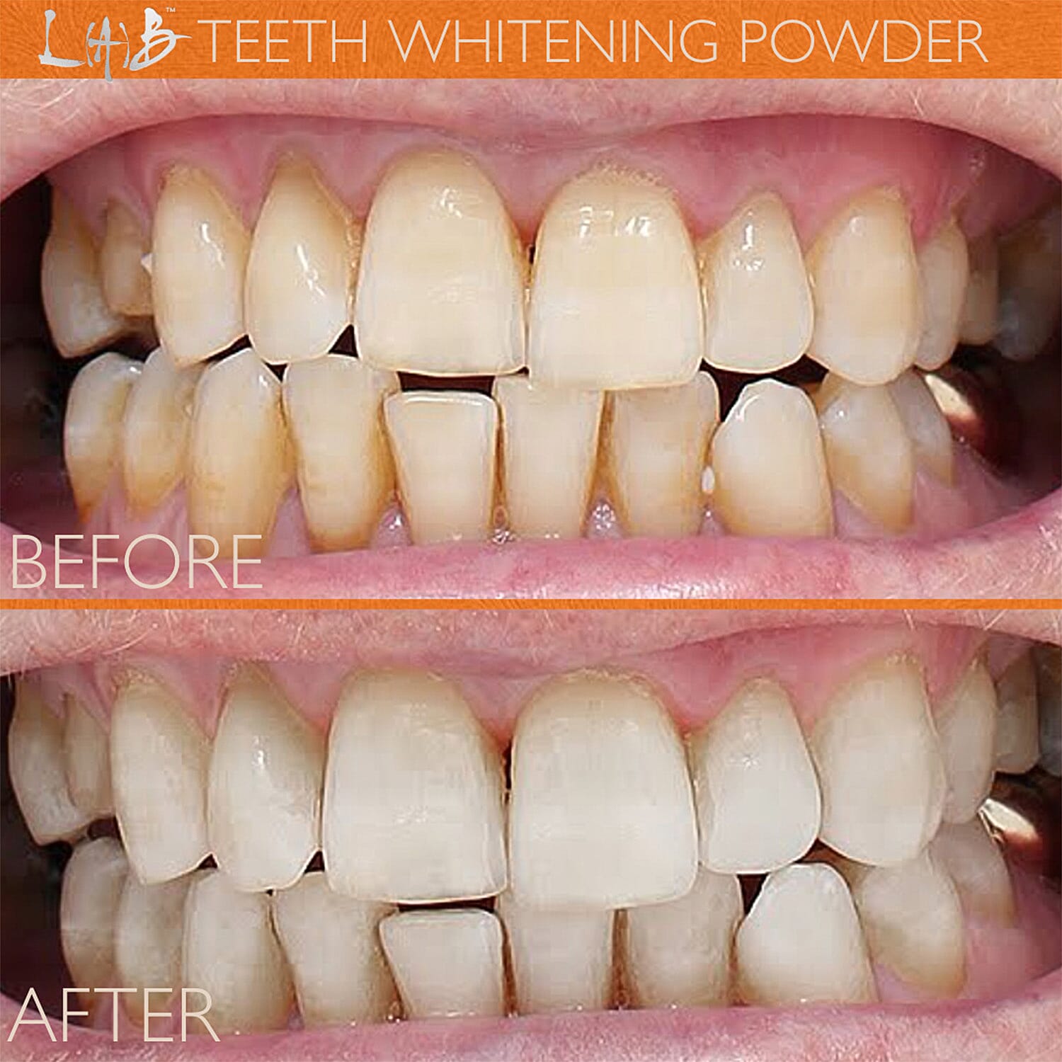 Lab Life Whitening Powder