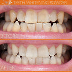 Lab Life Whitening Powder
