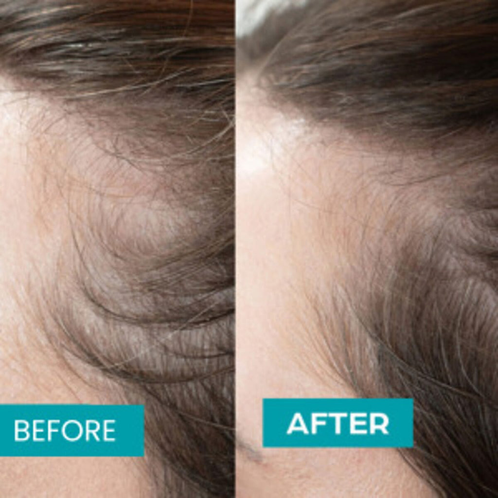 NuMii Everyday Hair Boost 3 Months Supply