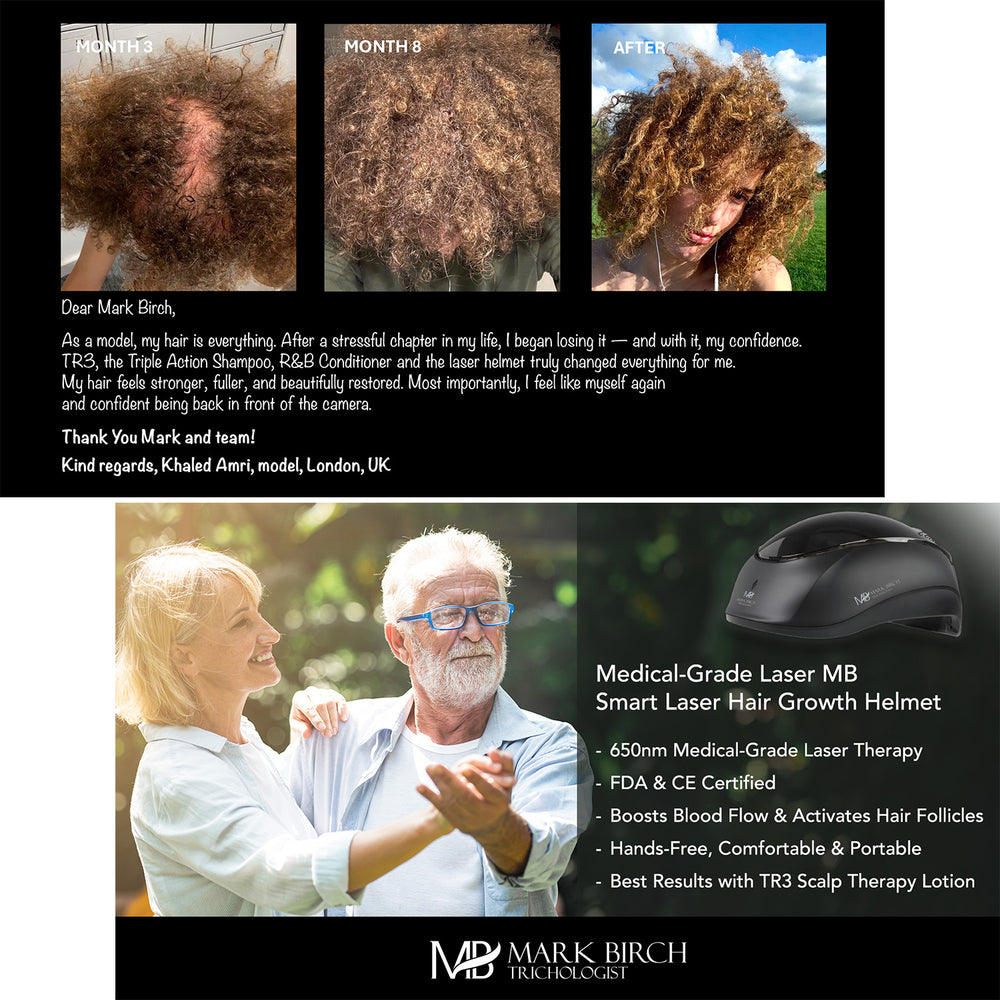 Mark Birch Trichologist Smart Laser & LED Hair Growth Helmet_8313161_8