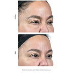 Elizabeth Grant Professional Institute Hyaluron Serum and Face Cream Duo