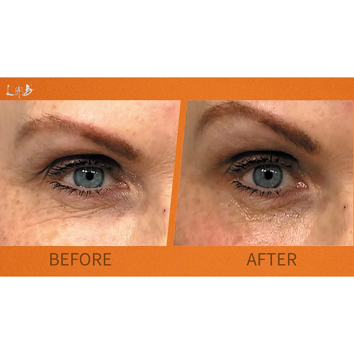 Lab Life Dermal De-Ageing Serum - The First Biomimetic Skincare