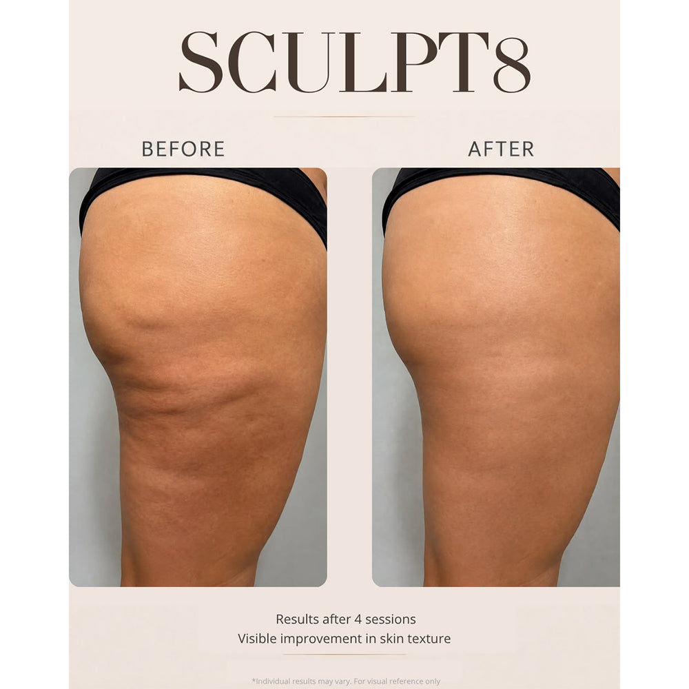 Luna'mour Sculpt8 Lymphatic Drainage & Body Contour Beauty Massager_8548031_5