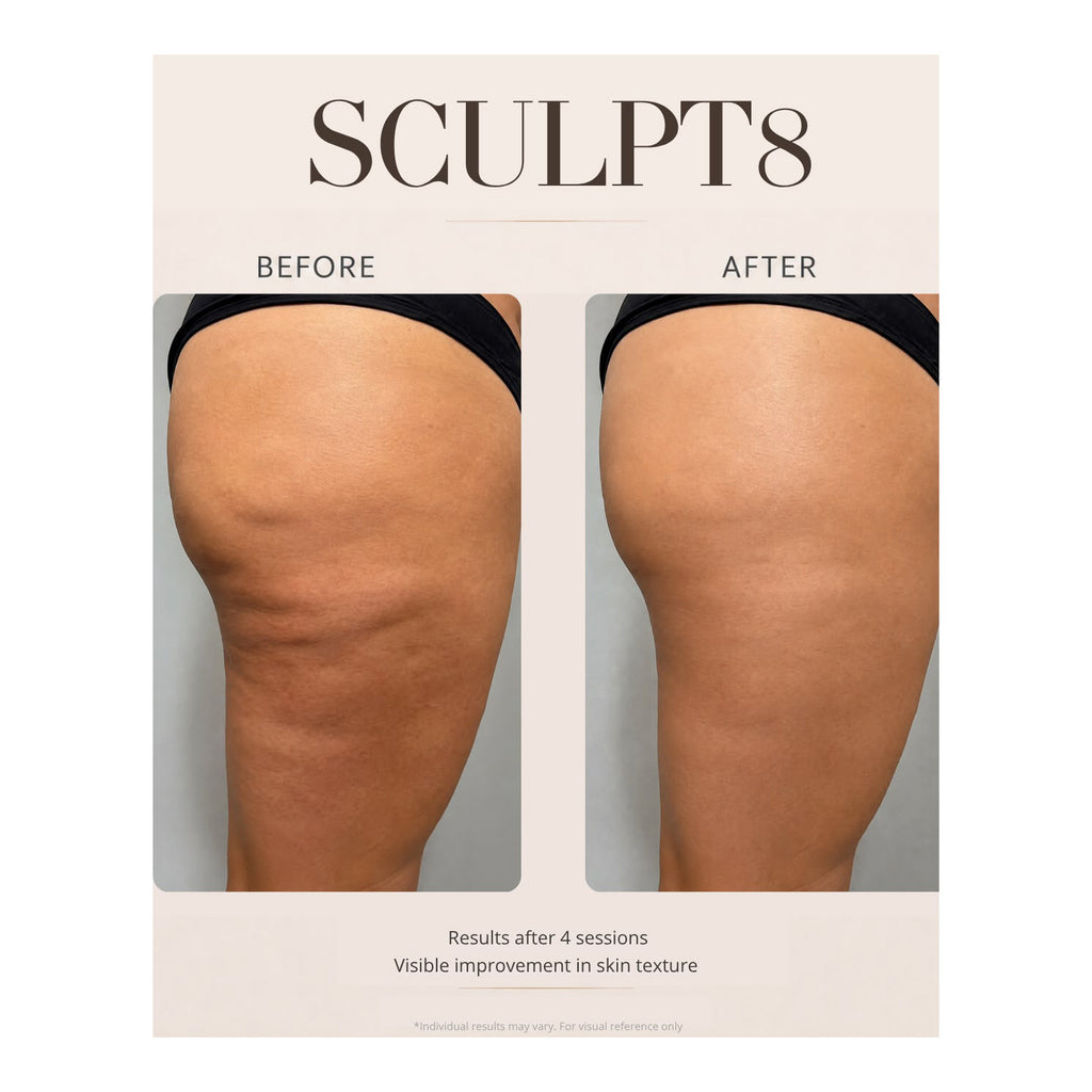 Luna'mour Sculpt8 Lymphatic Drainage & Body Contour Beauty Massager_8548031_5