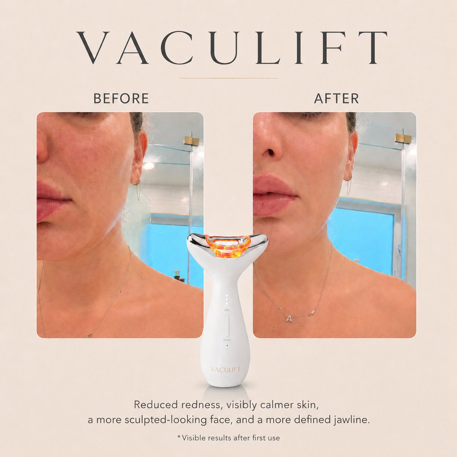 LUNA'MOUR VacuLift Advanced Suction Face & Neck Sculpting Device_8548034_5