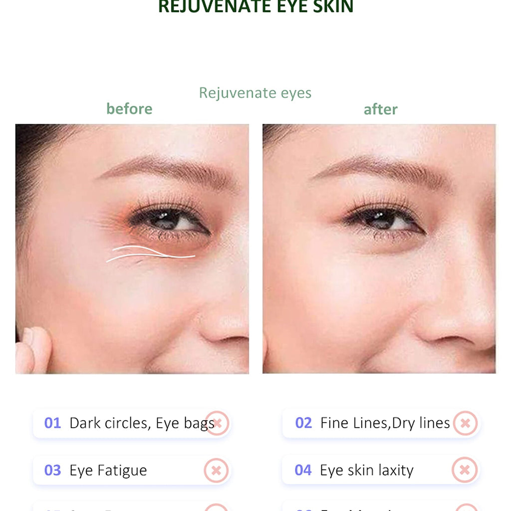 Lowest Ever Price- Erth Beauty Eye Recovery Pro Massager
