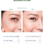 Lowest Ever Price- Erth Beauty Eye Recovery Pro Massager