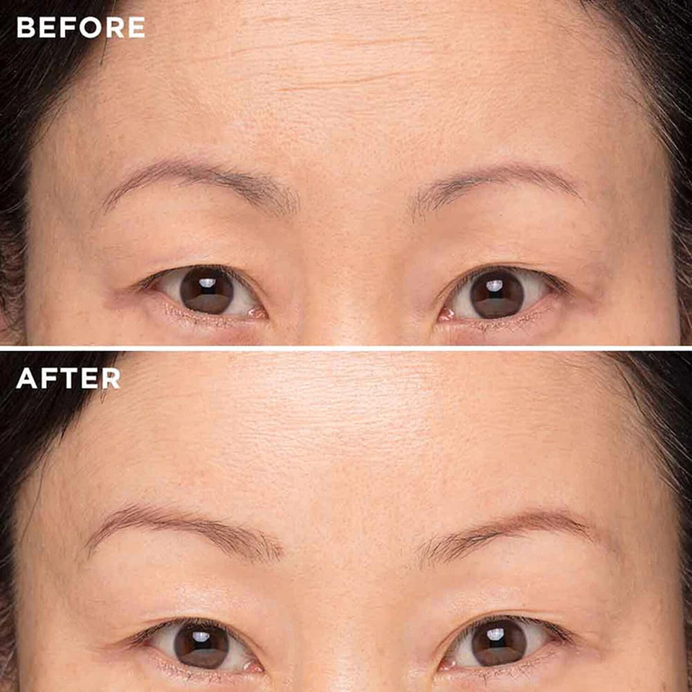 MIE Skincare- Deep Line Elixir