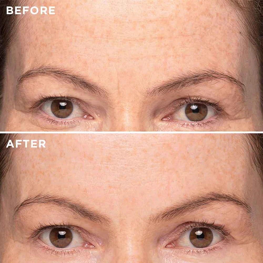 MIE Skincare- Deep Line Elixir