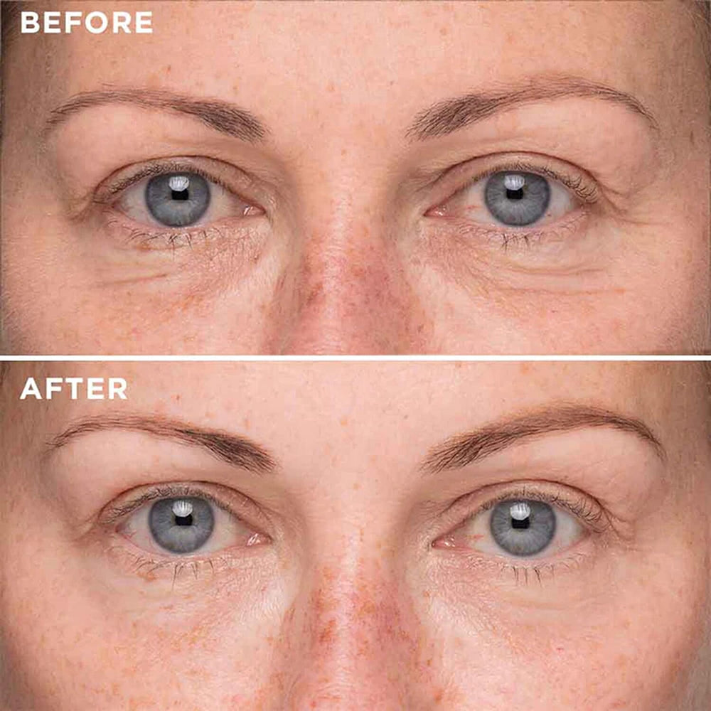 MIE Skincare- Triple Complex Eyes Lift Serum - 8ml