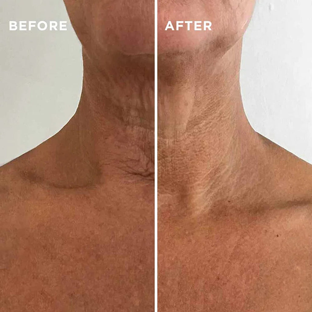 Instant Effects - Neck & Chest Rejuvenating Serum 30 ml