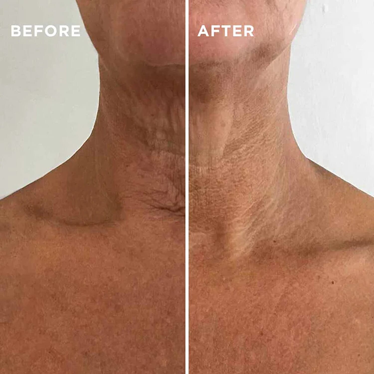 Instant Effects - Neck & Chest Rejuvenating Serum 30 ml