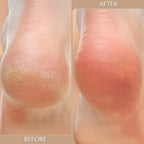 Beauty March-End Madnes Deals-Lab Life Beauty Double Sided Pebble Plus - Bladeless Hair and Dry Skin Removal