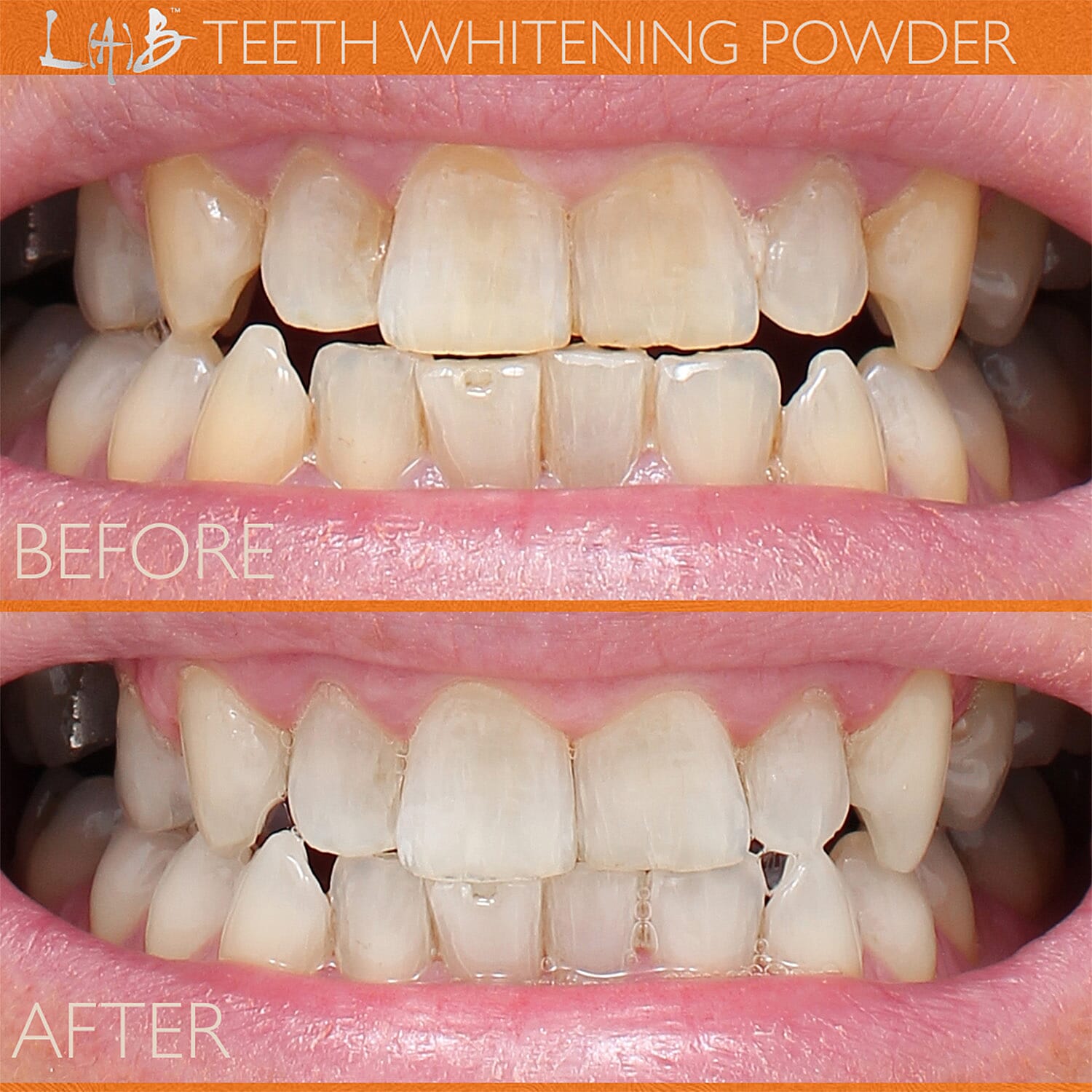 Lab Life Whitening Powder