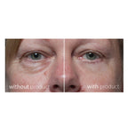 My Perfect Cosmetics- My Perfect Eyes 20ml (With Free My Perfect Eyes - 10ml)