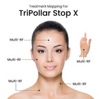 TriPollar Stop X KIT- Includes TriPollaR Stop X Device, Power Adapters - Preparation Gel - 50ml